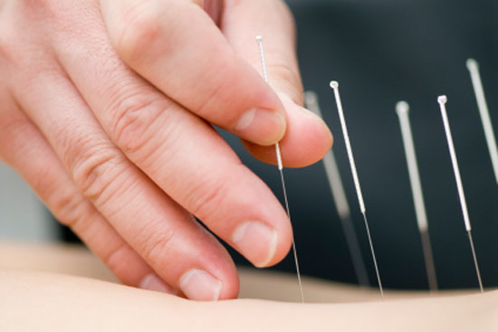 Body/Mind Services - Acupuncture